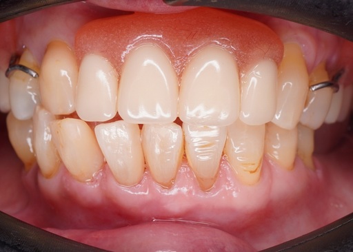 cloesup-teeth-filling-icon