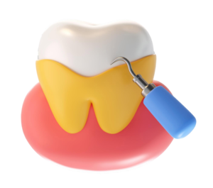 stained-teeth-img